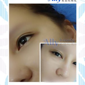customer-sample-eyeliner
