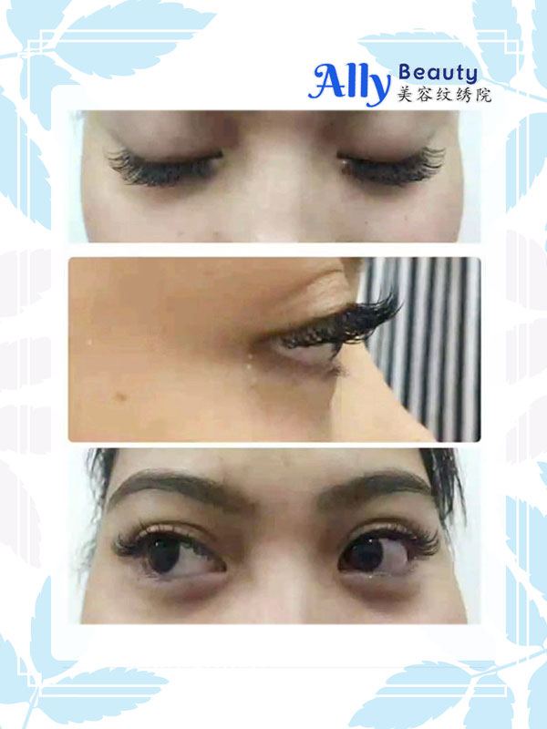 eyelash extension sample 03